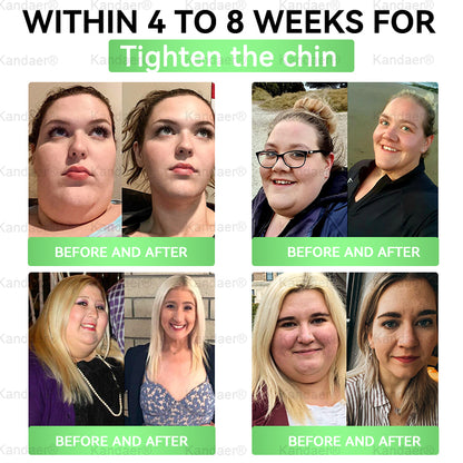 𝐊𝗮𝗻𝐝𝒂𝒆𝒓®Only 5 boxes left! We're offering you an additional 30% discount! Get yourself in shape and healthy. Miss out now, and you won't have another chance until next year.