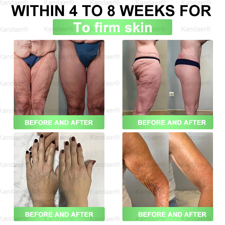 𝐊𝗮𝗻𝐝𝒂𝒆𝒓®Only 5 boxes left! We're offering you an additional 30% discount! Get yourself in shape and healthy. Miss out now, and you won't have another chance until next year.